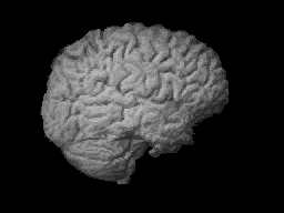 Image:Brain 1.gif